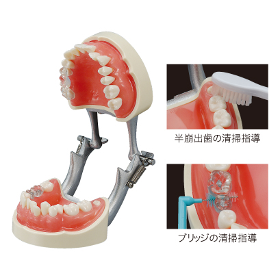 その他 義歯デモンストレーションモデル／看護実習モデル 【上顎