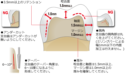 支台歯形成の注意点
