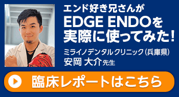 EDGE ENDを実際に使ってみた！安岡大介先生