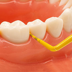 歯間部に挿入し、メモリを確認、歯間サイズよりやや小さい歯間ブラシを選択してください。