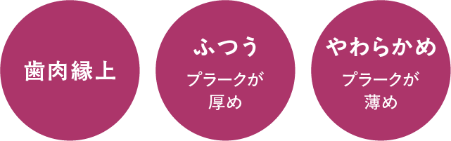 歯肉縁上、プラークが厚め：ふつう、プラークが薄め：やわらかめ